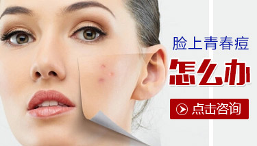 预防青春痘6大招