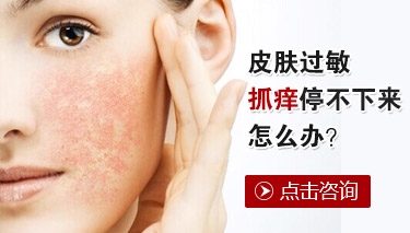 夏季皮肤过敏注意什么