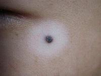 ����ţƤѢ��������ҽԺ