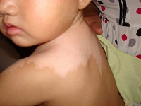 ����ţƤѢҽԺר��