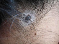 ����ţƤѢ������Ҫ����Ǯ