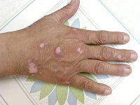 ����ţƤѢ���ƶ���Ǯ