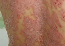 ��������ţƤѢҽԺ