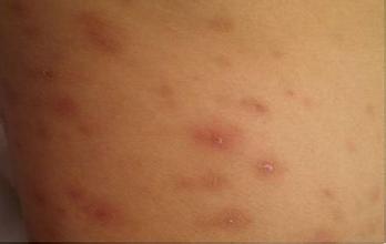 �����ļҿ�ţƤѢ���