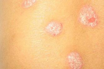 ����ţƤѢר��ҽԺ