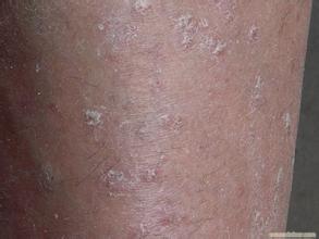 ����ţƤѢ����ô��