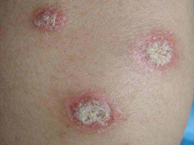 ����ţƤѢҽԺ�ļҽϺ�